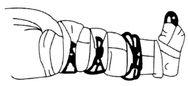 打结衣服简笔画 打衣服教程简笔画